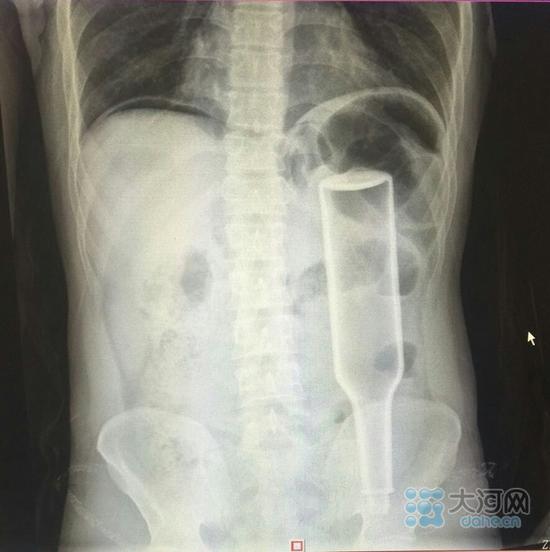 ����Ƭ�ӣ���¶ˮƿ���Ѿ��ܡ����롱�ˡ�